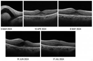 RETINA-CHALLENGE-0