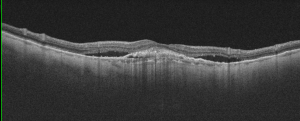 Fig.1-0