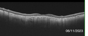 Fig.3-2
