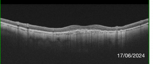 Fig.6-5