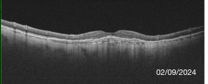 Fig.7-6